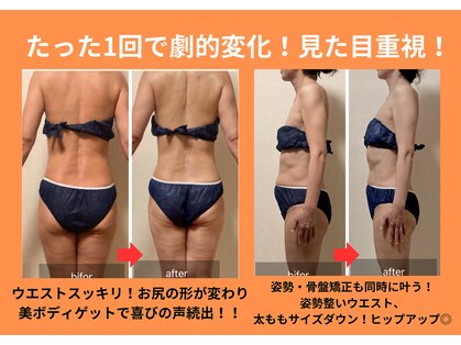 ヨサパーク セルヴィ(YOSA PARK セル美)の写真
