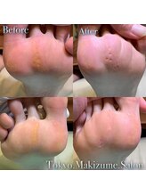 巻き爪補正店 那覇店/