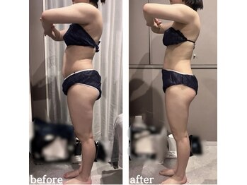 トランジット(transit)/2カ月/before &nbsp;&nbsp;after