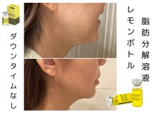 フォーユー マシバメディカル(For You Mashiba Medical)の雰囲気（韓国美容！地域最新　小顔、二重アゴすっきり！）