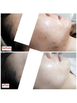 ミュー(Mieux)/こんなに違うなんて！