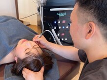 美容鍼もお任せ下さい◎スッキリとしたフェイスラインに♪