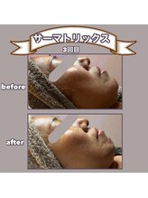 ビーマジック(美magic)/サーマトリックス