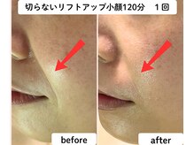 ユーフォリア(Euphoria)