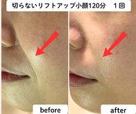 ユーフォリア(Euphoria)