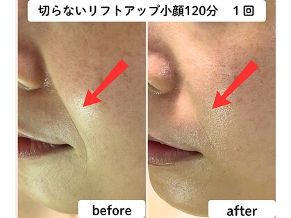 ユーフォリア(Euphoria)の写真