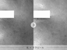 スパレーカ(Spa laka)/シミ・目尻のシワ