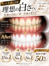博多ホワイトニング福岡 小倉駅前店&nbsp;ホワイト BeforeAfer