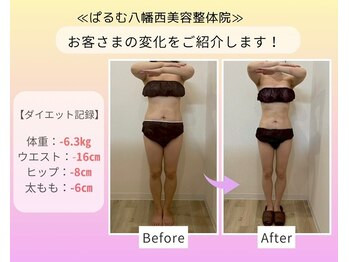 ぱるむ八幡西美容整体院の写真/【産後の体型戻し】食事指導×ピラティスで作る一生モノの「痩せ見え」ボディ!産前より綺麗な私へ★