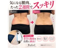ラフィールの雰囲気（光フォト/肌のトーンアップ/しわ改善/特に首ケアには！最適◎）