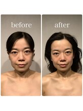 グレースフィオーレ 町田店(gracefiore)/ビフォーアフター/施術1回の効果