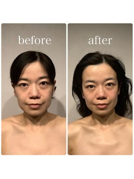 グレースフィオーレ 町田店(gracefiore)/ビフォーアフター/施術1回の効果