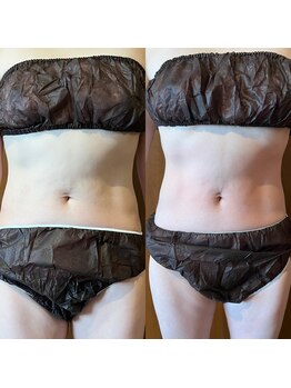 マロカ(Marroka)/40代。運動習慣なし