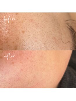 ノン(Non.)/ヌクレールフェイシャルワックス