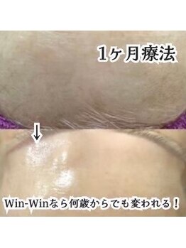ウィンウィン 新山口店(Win Win)/艶肌へ