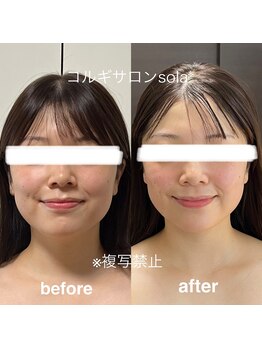 ソラ(sola*)/小顔愛されフェイス