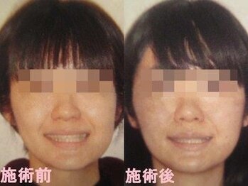 ドクター ヴィーナス/歪み改善の症例