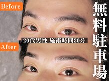 ヒゲ脱毛、全身脱毛、VIO脱毛、眉毛専門#脱毛#メンズ脱毛