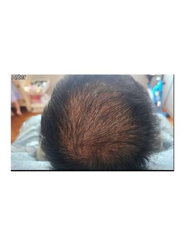 カブール 町田/たった数回でボリュームアップ