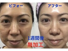 ヴィーナスハンドの雰囲気（大人気★ハーブピーリング（ハーバルシー）スピーディーな肌改善）