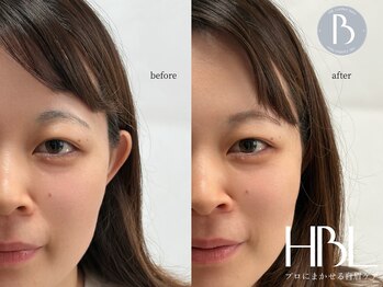 リノラナ(Lino Lana)の写真/【HBL公式推奨サロン】毎朝の眉ストレスを卒業♪ノーメイクでも自信が持てる眉へ