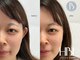 リノラナ(Lino Lana)の写真/【HBL公式推奨サロン】毎朝の眉ストレスを卒業♪ノーメイクでも自信が持てる眉へ