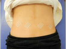 りらく整体 あおば/テーピング1