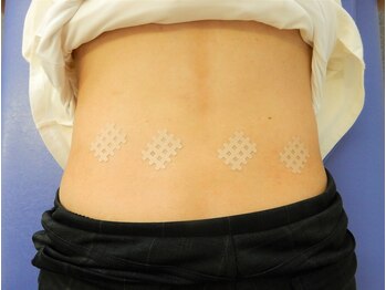 りらく整体 あおば/テーピング1