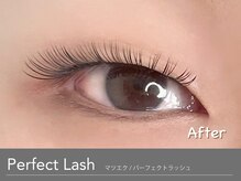 アンモス 日本橋店(Ann Moss)/瞼(まぶた)に合わせた施術が人気