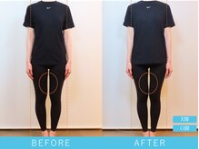 ビューティーマジック 恵比寿 広尾(beauty magic)/全身コース1回 【美容整体】