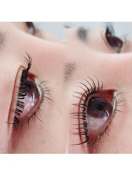 コア(Koa)/エクステパーマ