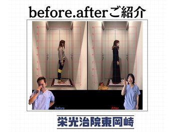 栄光治院 整体院東岡崎/姿勢が変わると人生が変わる
