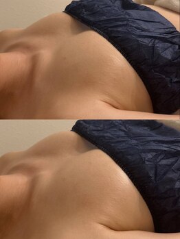 ミリミリ(mili mili)/before→after