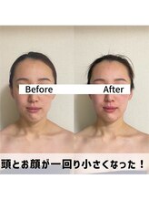 お顔の研究所/ビフォーアフター写真♪
