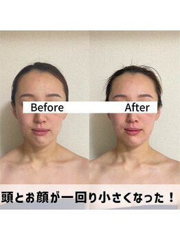 お顔の研究所/ビフォーアフター写真♪