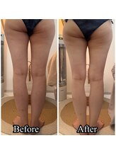 サロンドプレマージュ(Salon de Premage)/痩身は結果重視！！