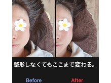 美容矯正サロン レレポノ(LELEPONO)/