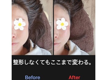 美容矯正サロン レレポノ(LELEPONO)/