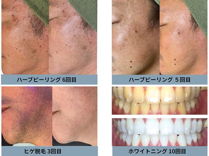 レオンザビューティー(REON the BEAUTY)の写真