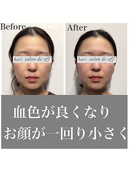 ハリサロンドオフ 心斎橋店(hari salon de off)/お顔が一回り小さく♪