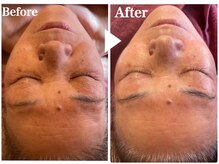 サロンリエム(Salon Riem.)/【before after】