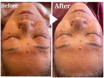 サロンリエム(Salon Riem.)/【before after】