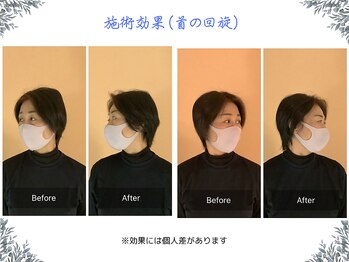ボディ リセット アンド デザイン(Body Reset & Design)/【施術例】ビフォーアフター