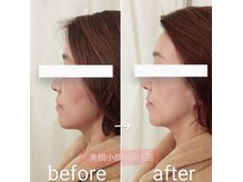 麻布十番デイジーの雰囲気（メディセルで頭～デコルテを筋膜リリース→美顔器で美肌小顔爆誕）