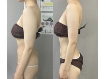 ヴィノ アイサロン(VINNO eyesalon)/巻き肩、ストレートネックの方に