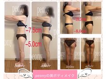 ピオニー(PEONY)の雰囲気（最強の本格エステのbefore‐afterはブログやInstagramへ！）