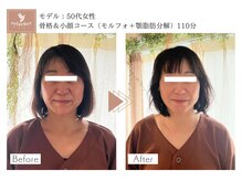 ルラシェ(relacher)/ビフォーアフター