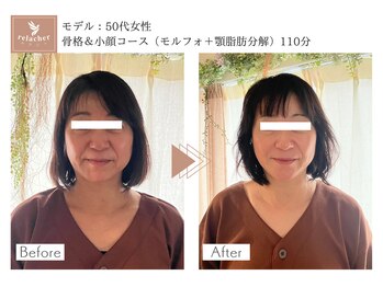 ねむりの止まり木/ビフォーアフター