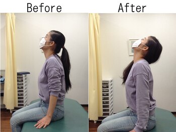 ライズ整体院/【猫背・スマホ首・骨盤矯正】