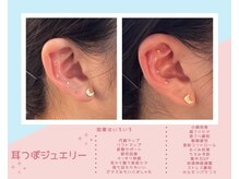 丸太町骨盤整骨院 鍼灸院/耳つぼジュエリー